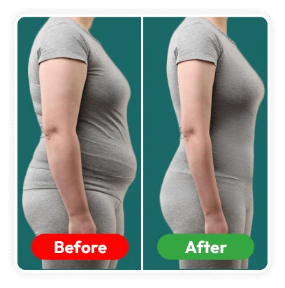 Female Weight Loss Before After